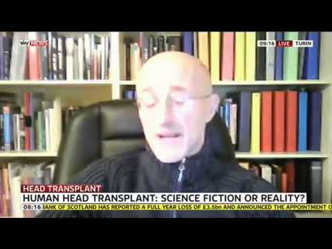 head transplant science fiction or reality